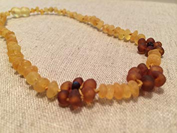Baltic Amber 15 Inch Raw Lemon Flower Necklace. Teen child some adults. Anti-inflammatory, cramps,...