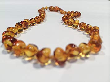 Luxury Baltic Amber Teething Necklace Allergy Asthma Relief Drooling Baby Infant Pain Toddler Teether...